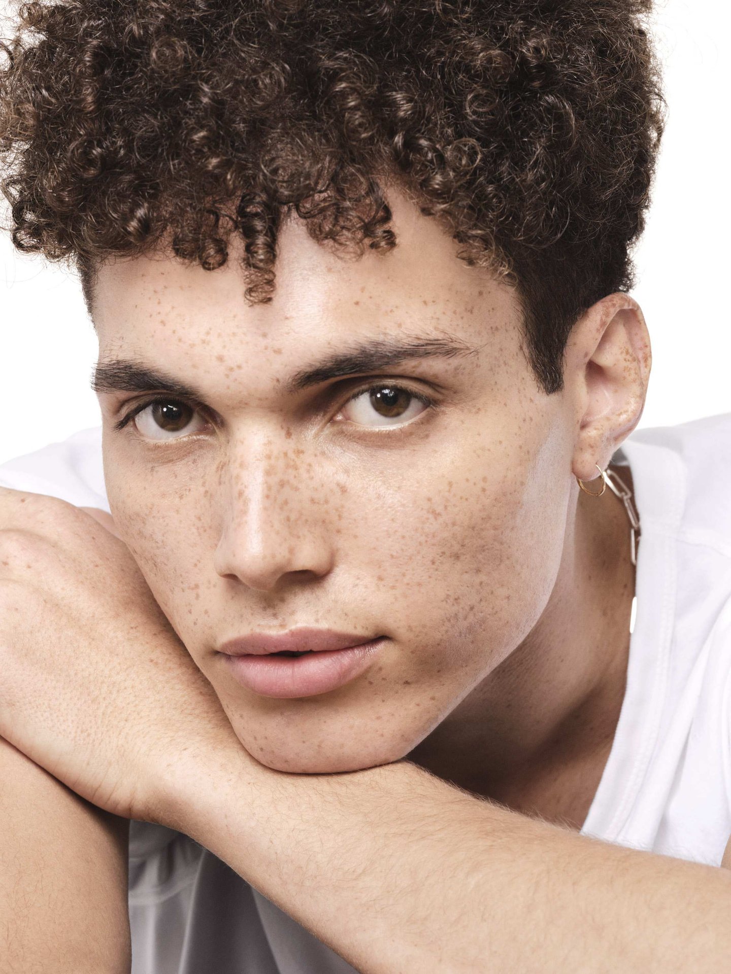 حب الشباب في الشتاء: كيفية إدارة البشرة الجافة المعرضة للعيوب