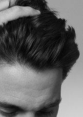 everything-you-need-to-know-about-adherent-dandruff