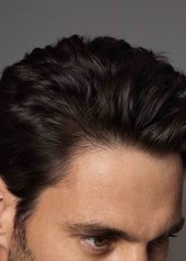 stages-of-hair-loss-how-to-act-fast