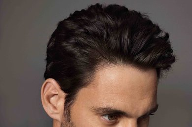 stages-of-hair-loss-how-to-act-fast
