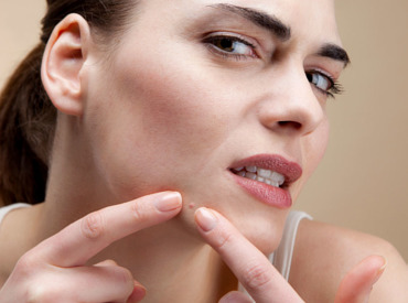 What is fungal acne and how can you treat it?