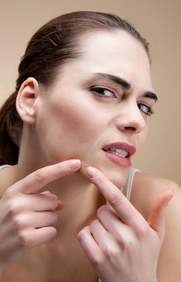 What is fungal acne and how can you treat it?